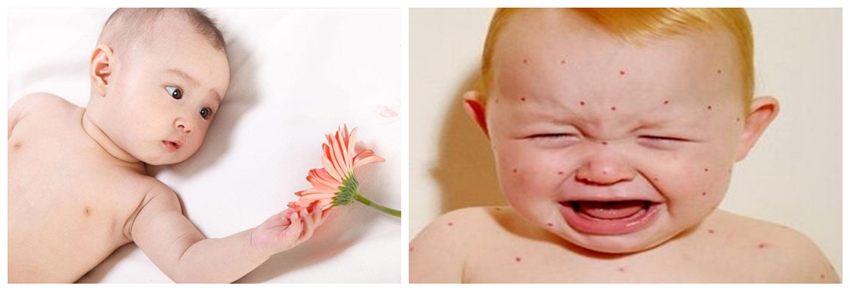 兒童濕疹反反復復，您有在家安裝家用除濕產品嗎？